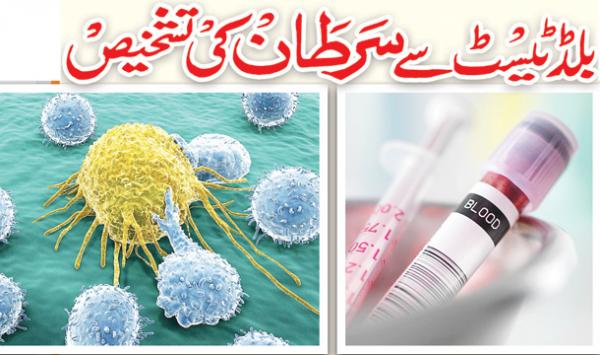 Blood Test Say Sartan Ki Tashkhees