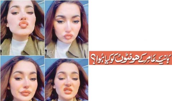 What Happened To Haniya Amirs Lips