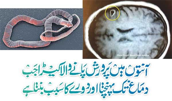Intestinal Worms Reach The Brain And Cause Seizures