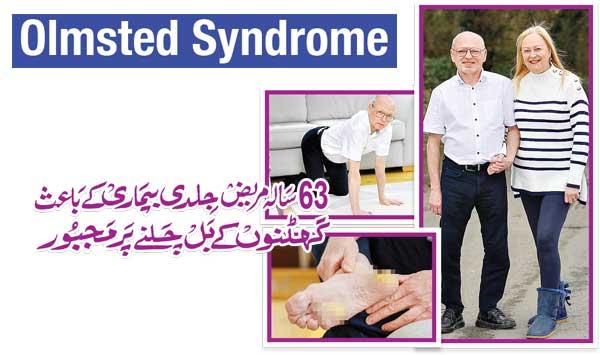 A 63 Year Old Patient Was Forced To Walk On His Knees Due To A Serious Illness