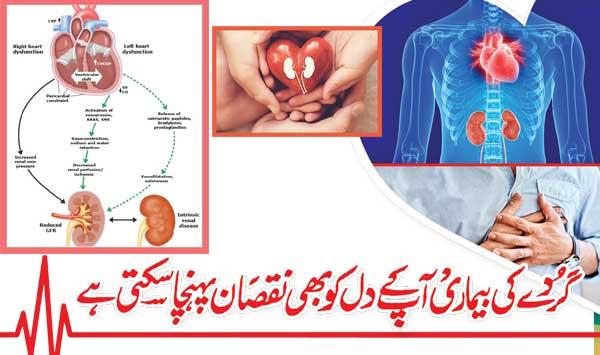 Kidney Disease Can Also Damage Your Heart