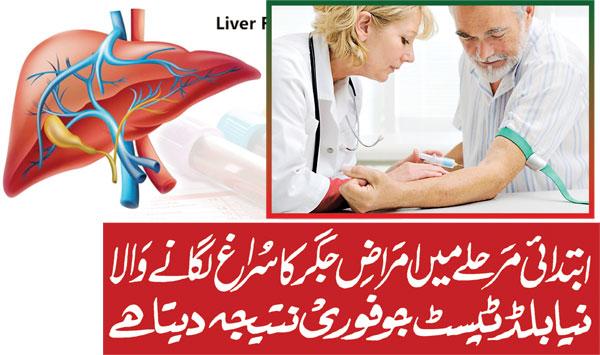 A New Blood Test To Detect Early Stage Liver Disease That Gives Immediate Results