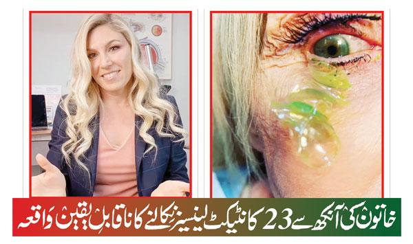 Unbelievable Incident Of Removing 23 Contact Lenses From A Womans Eye