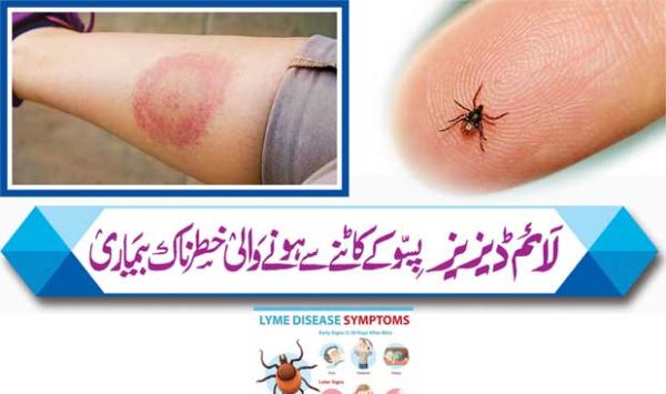 Lyme Disease Is A Dangerous Disease Caused By Flea Bites