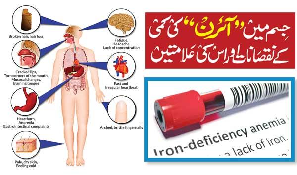 Losses Of Iron Deficiency In The Body And Its Symptoms