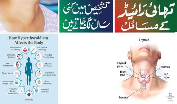 Thyroid Problems Take Years To Diagnose