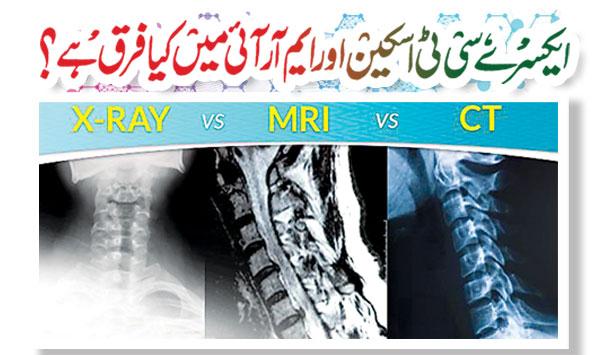 What Is The Difference Between X Ray Ct Scan And Mri