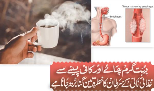 Drinking Very Hot Tea And Coffee Increases The Risk Of Esophageal Cancer Threefold